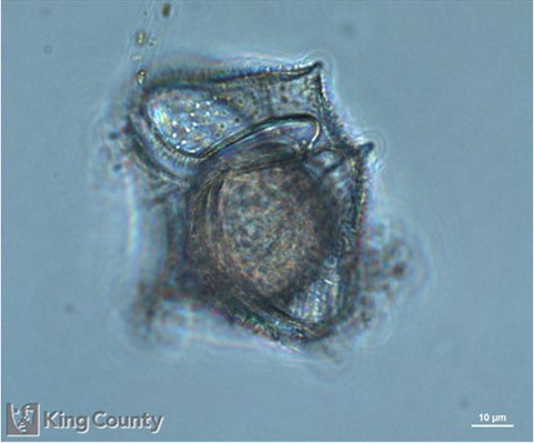 Photo of Protoperidinium conicum/Protoperidinium leonis